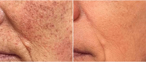 IPL Before and After